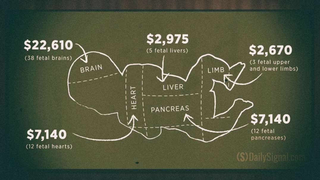 The Horrifying Fetal Body Parts Market