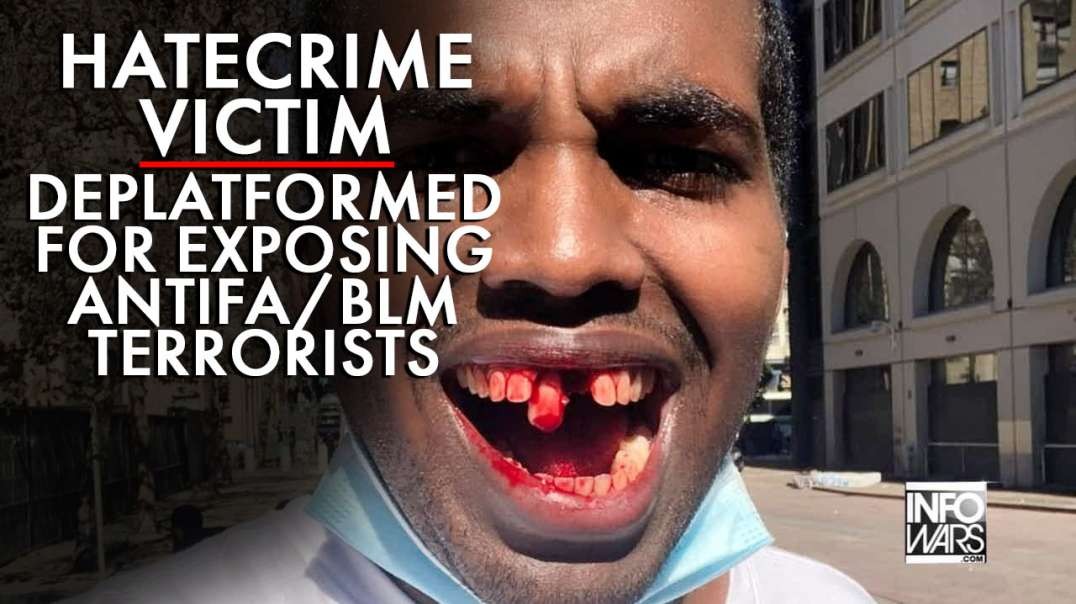 Black Hate Crime Victim Deplatformed for Exposing Antifa/BLM Terrorists